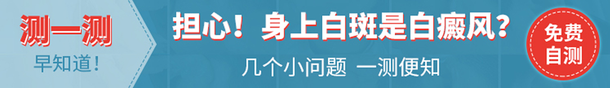 长沙治疗白癜风